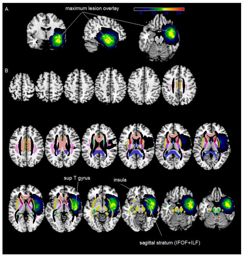 https://cdn.ncbi.nlm.nih.gov/pmc/blobs/13d5/11674248/23579b0df8bc/curroncol-31-00595-g002.jpg