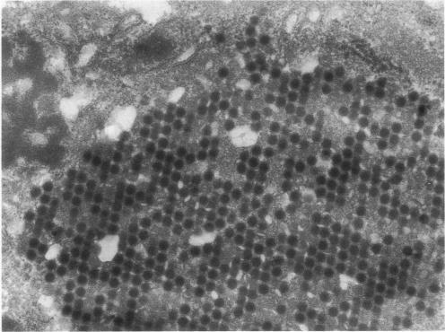 https://cdn.ncbi.nlm.nih.gov/pmc/blobs/13d5/2047586/1412b817ae41/amjpathol00406-0078-a.jpg