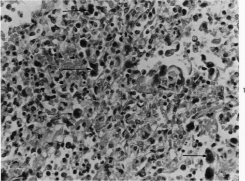 https://cdn.ncbi.nlm.nih.gov/pmc/blobs/13d5/2047586/19ee34be6303/amjpathol00406-0077-a.jpg