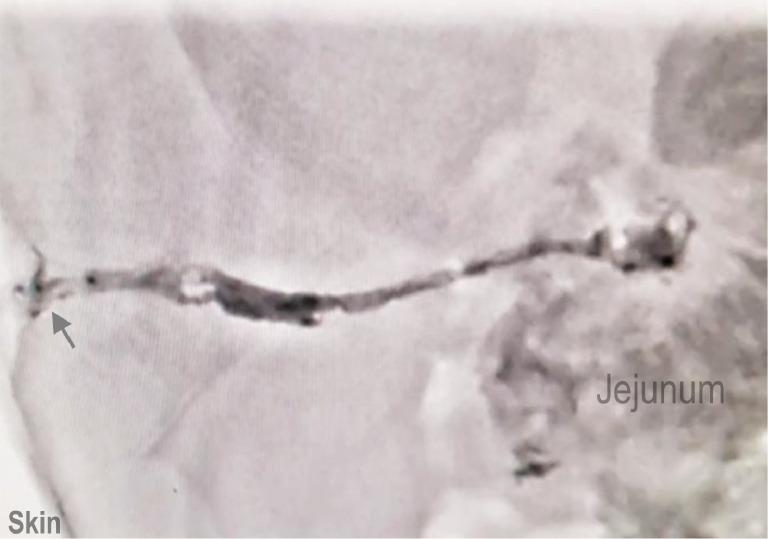 https://cdn.ncbi.nlm.nih.gov/pmc/blobs/13d6/12136877/4337a7eb0b13/gr2.jpg