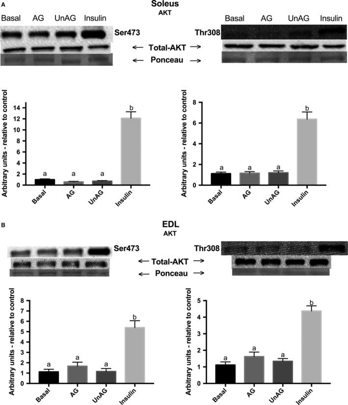 https://cdn.ncbi.nlm.nih.gov/pmc/blobs/13da/5506520/b73da4c06f23/PHY2-5-e13320-g004.jpg