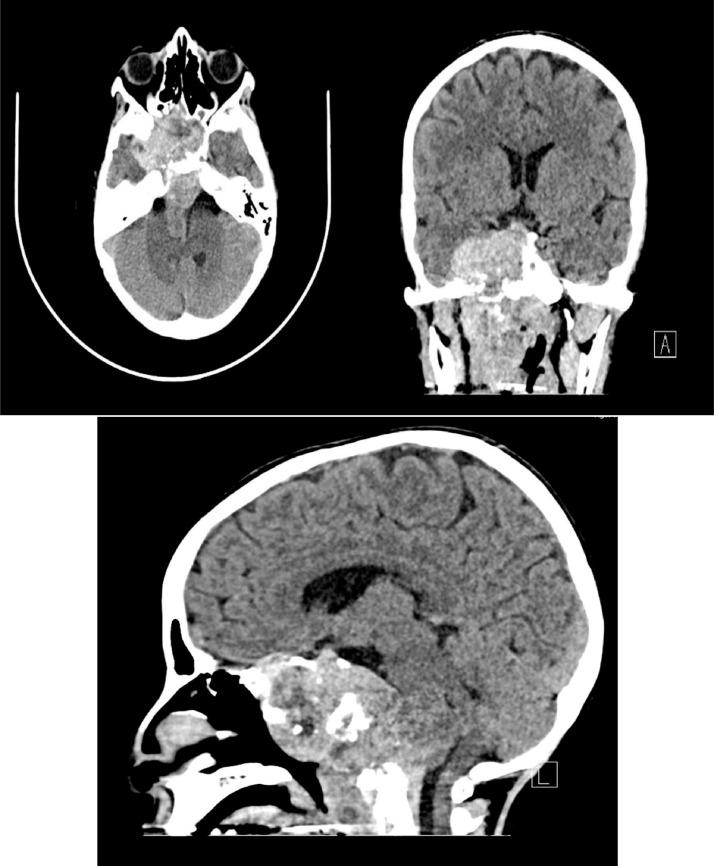 https://cdn.ncbi.nlm.nih.gov/pmc/blobs/13fe/8164003/28c16c534351/gr1.jpg
