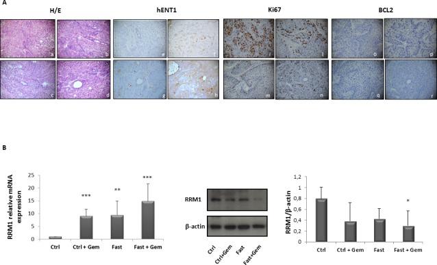 https://cdn.ncbi.nlm.nih.gov/pmc/blobs/1407/4621909/3a92fbdeac3c/oncotarget-06-18545-g007.jpg