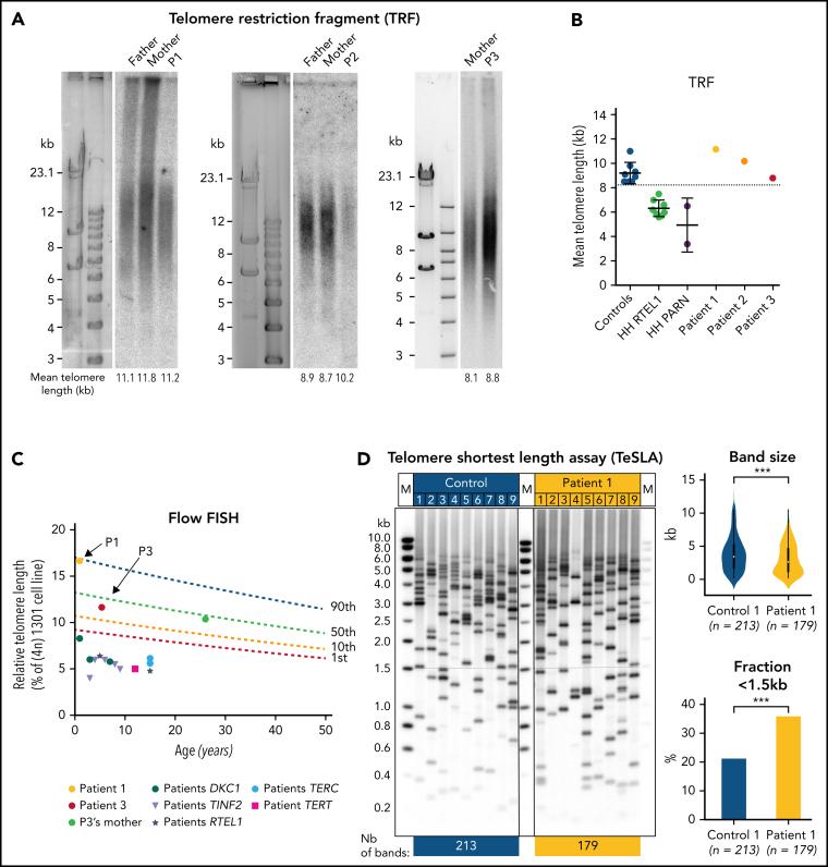 https://cdn.ncbi.nlm.nih.gov/pmc/blobs/1409/11022855/162478e5c38d/bloodBLD2021010791f1.jpg