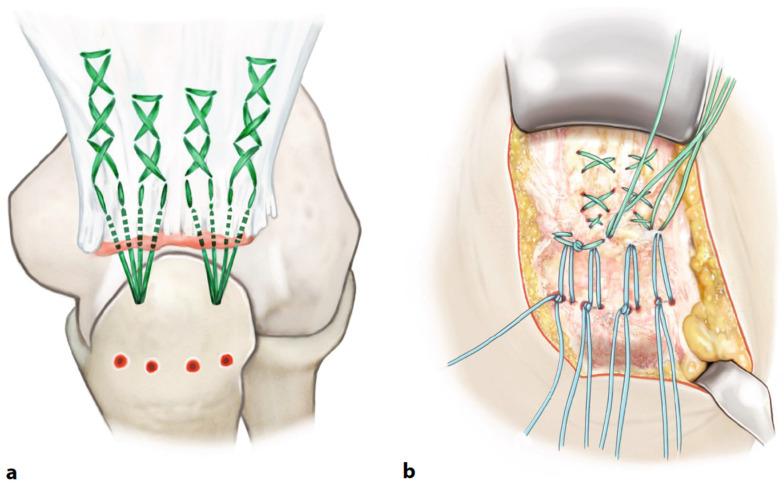 https://cdn.ncbi.nlm.nih.gov/pmc/blobs/140c/11355401/e7952a84df50/jcm-13-04913-g001.jpg