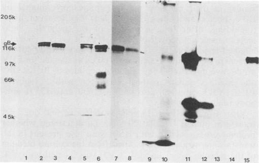 https://cdn.ncbi.nlm.nih.gov/pmc/blobs/1410/254073/9a0650114a7c/jvirol00095-0193-b.jpg