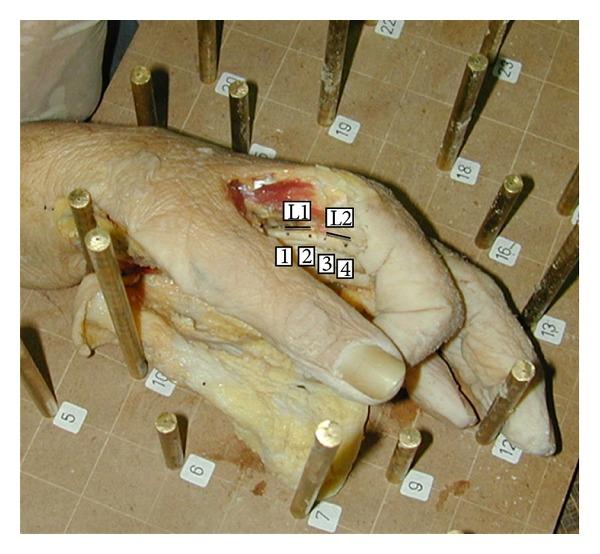 https://cdn.ncbi.nlm.nih.gov/pmc/blobs/1413/3710653/3468e2553a1a/TSWJ2013-630617.001.jpg