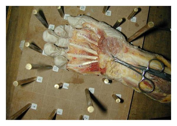 https://cdn.ncbi.nlm.nih.gov/pmc/blobs/1413/3710653/d9493fc679b6/TSWJ2013-630617.002.jpg