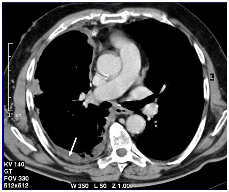 https://cdn.ncbi.nlm.nih.gov/pmc/blobs/1414/8430786/f13572d724ea/cancers-13-04377-g001.jpg