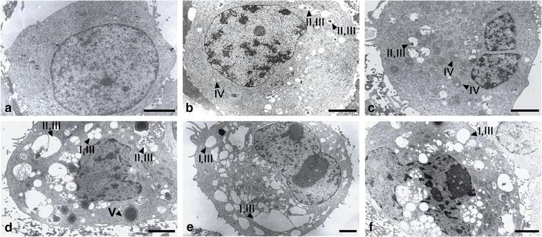 https://cdn.ncbi.nlm.nih.gov/pmc/blobs/141b/4754822/e0d74b6c61f0/12935_2016_288_Fig7_HTML.jpg