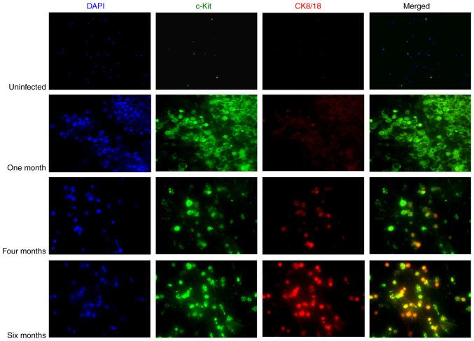 https://cdn.ncbi.nlm.nih.gov/pmc/blobs/141b/7864146/2bdf16d2b69a/IJO-58-03-0388-g00.jpg