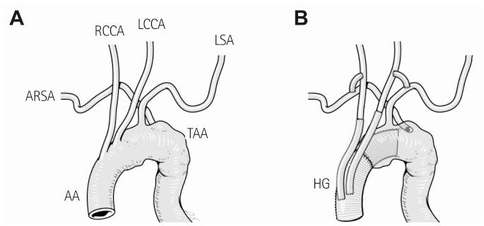 https://cdn.ncbi.nlm.nih.gov/pmc/blobs/1422/3569571/86df89f31b6f/kcj-43-66-g002.jpg