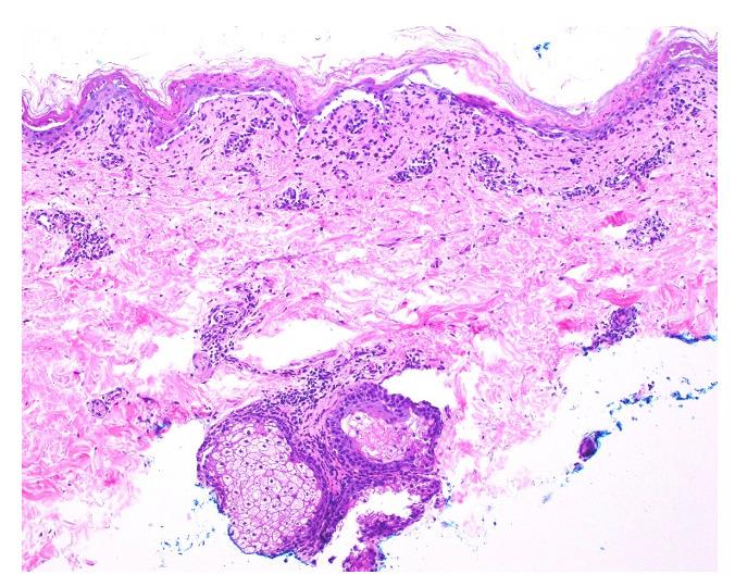 https://cdn.ncbi.nlm.nih.gov/pmc/blobs/1428/11966765/8e9a875f62c1/bhm_2025_4_2_130831_268305.jpg