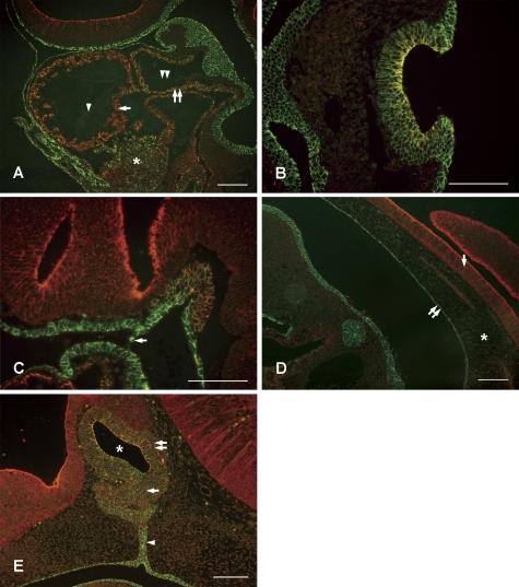 https://cdn.ncbi.nlm.nih.gov/pmc/blobs/142a/2576505/1c46857effb7/AHC08026f02.jpg
