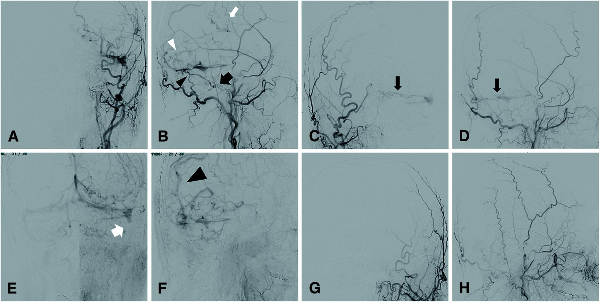 https://cdn.ncbi.nlm.nih.gov/pmc/blobs/142c/10800167/8929e1636555/jnet-18-24-g003.jpg