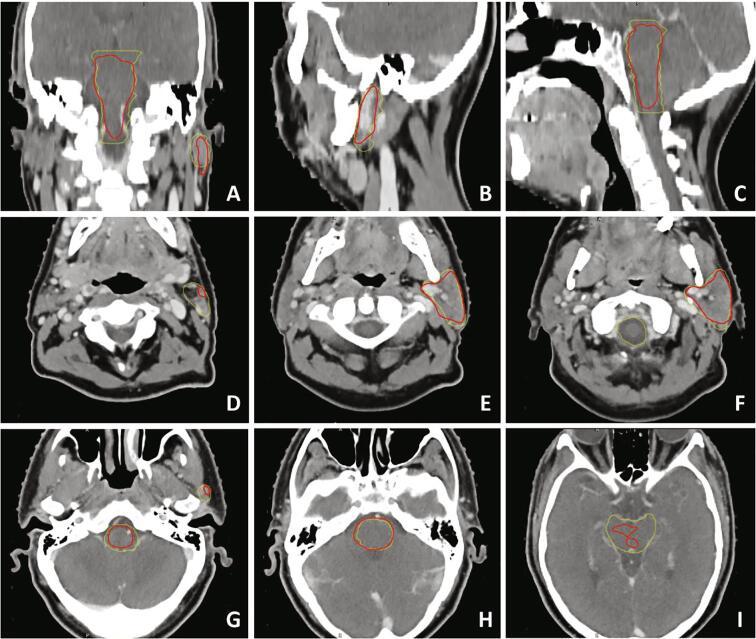 https://cdn.ncbi.nlm.nih.gov/pmc/blobs/142c/7807543/fd8c254632f6/gr2.jpg