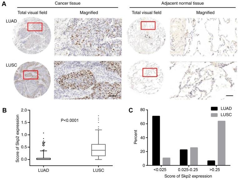 https://cdn.ncbi.nlm.nih.gov/pmc/blobs/142f/6096237/9fd8a198d332/ol-16-03-2873-g00.jpg