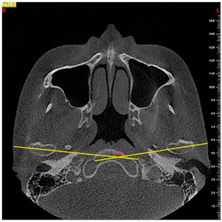 https://cdn.ncbi.nlm.nih.gov/pmc/blobs/142f/8002863/c98743710f0b/diagnostics-11-00541-g002.jpg