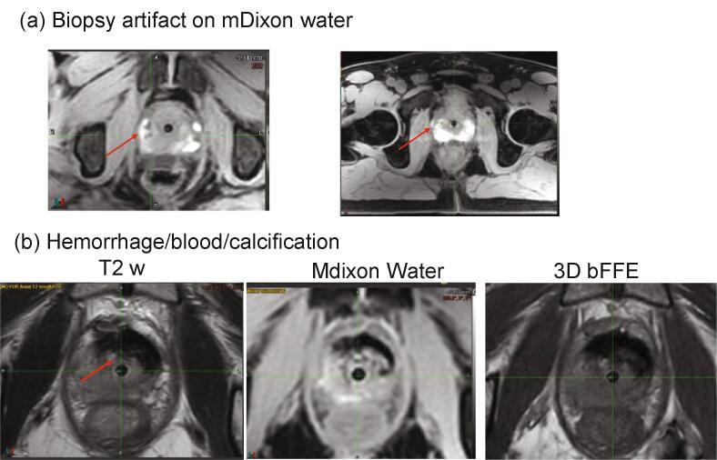 https://cdn.ncbi.nlm.nih.gov/pmc/blobs/1435/7807611/69cebf08fb24/gr3.jpg