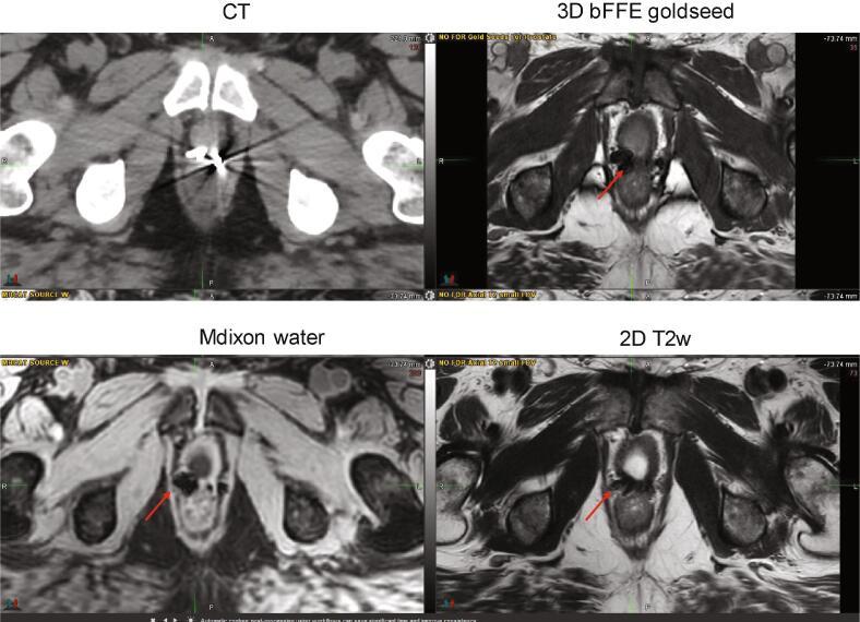 https://cdn.ncbi.nlm.nih.gov/pmc/blobs/1435/7807611/a0edbddfce7d/gr4.jpg