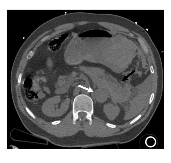 https://cdn.ncbi.nlm.nih.gov/pmc/blobs/143b/3178469/2313881e792c/1749-7922-6-27-1.jpg