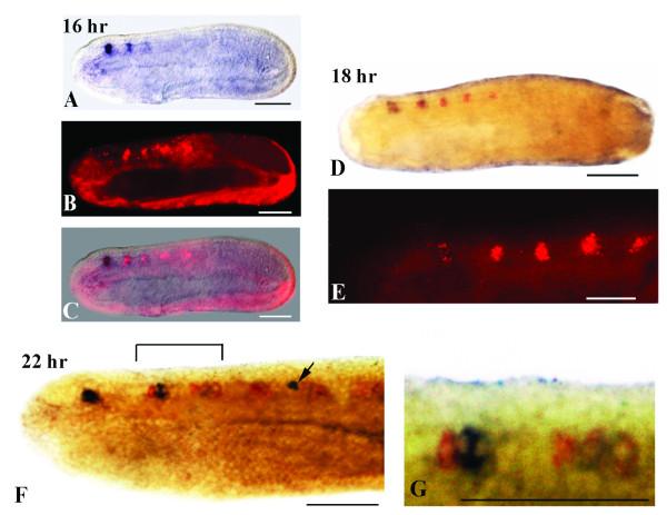 https://cdn.ncbi.nlm.nih.gov/pmc/blobs/143d/3484041/7d9bfd45940c/1471-2202-13-59-8.jpg