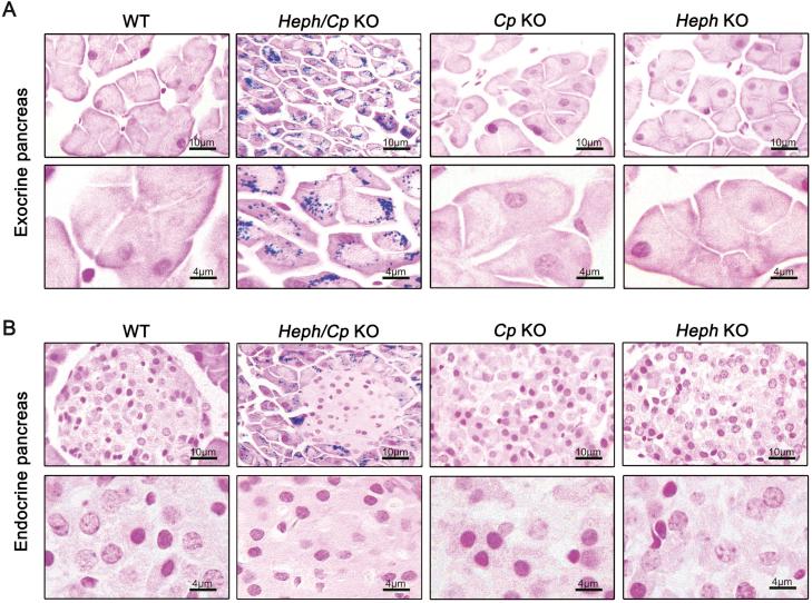 https://cdn.ncbi.nlm.nih.gov/pmc/blobs/1441/6007082/743ca4c76bf6/gr4.jpg