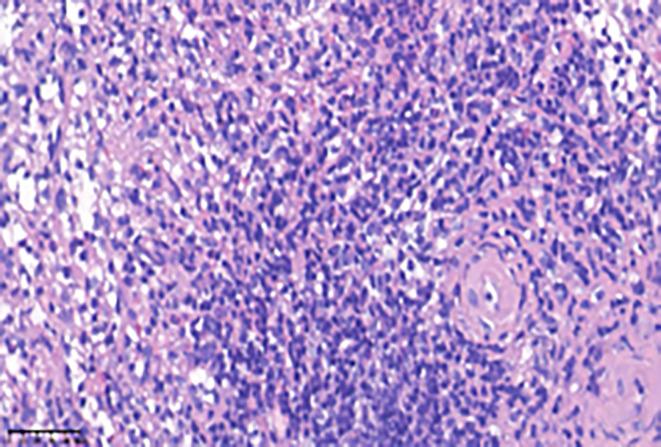 https://cdn.ncbi.nlm.nih.gov/pmc/blobs/1443/10921196/70c57e9ae461/WJGS-16-616-g004.jpg