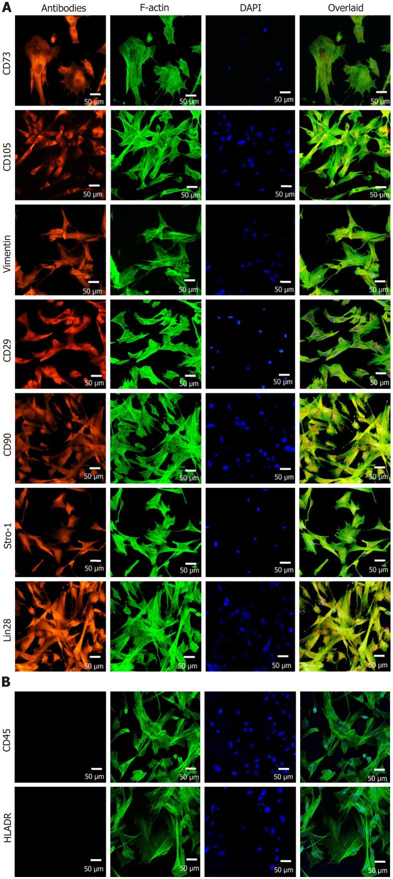 https://cdn.ncbi.nlm.nih.gov/pmc/blobs/1443/11056638/45960ca8b6d9/WJSC-16-410-g005.jpg