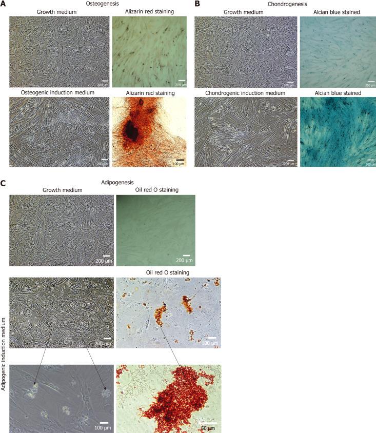 https://cdn.ncbi.nlm.nih.gov/pmc/blobs/1443/11056638/53b9d819577e/WJSC-16-410-g006.jpg