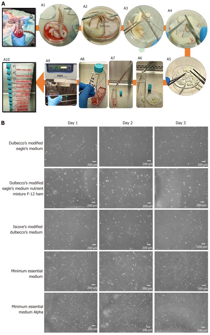 https://cdn.ncbi.nlm.nih.gov/pmc/blobs/1443/11056638/9cfebcddfd96/WJSC-16-410-g001.jpg