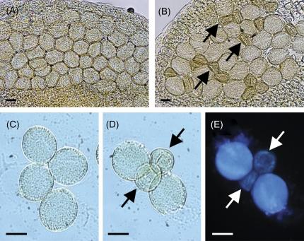 https://cdn.ncbi.nlm.nih.gov/pmc/blobs/1447/2682496/bcbe8516ca3b/jexboterp073f05_3c.jpg