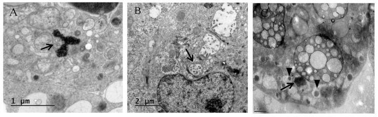https://cdn.ncbi.nlm.nih.gov/pmc/blobs/1447/5332944/fbf06d269aab/viruses-09-00025-g004.jpg