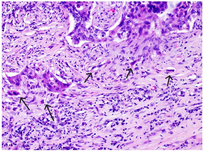 https://cdn.ncbi.nlm.nih.gov/pmc/blobs/144c/12346568/2f99b1a78622/diagnostics-15-01844-g003.jpg