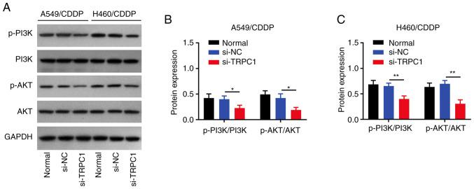 https://cdn.ncbi.nlm.nih.gov/pmc/blobs/1456/10157351/5179a9a473a5/ol-25-06-13810-g04.jpg
