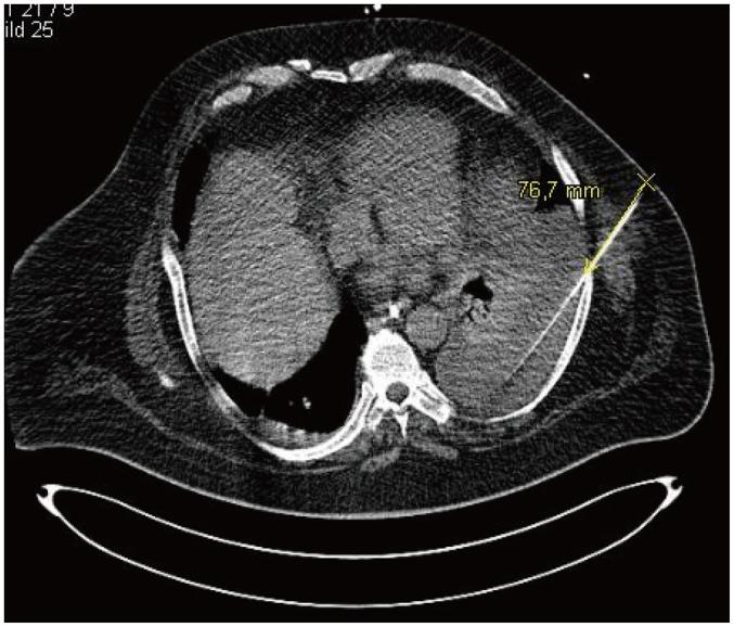 https://cdn.ncbi.nlm.nih.gov/pmc/blobs/145d/4499536/52f33e353602/kjr-16-729-g004.jpg