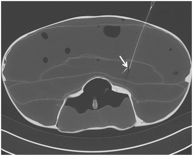 https://cdn.ncbi.nlm.nih.gov/pmc/blobs/145d/4499536/c0e08e106220/kjr-16-729-g003.jpg