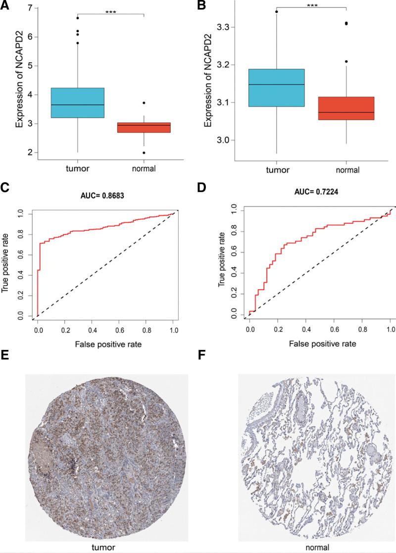 https://cdn.ncbi.nlm.nih.gov/pmc/blobs/145f/9857258/73ac27f58305/medi-102-e32686-g001.jpg
