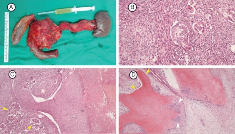 https://cdn.ncbi.nlm.nih.gov/pmc/blobs/1460/5466208/a52d9859a500/medi-96-e6961-g002.jpg