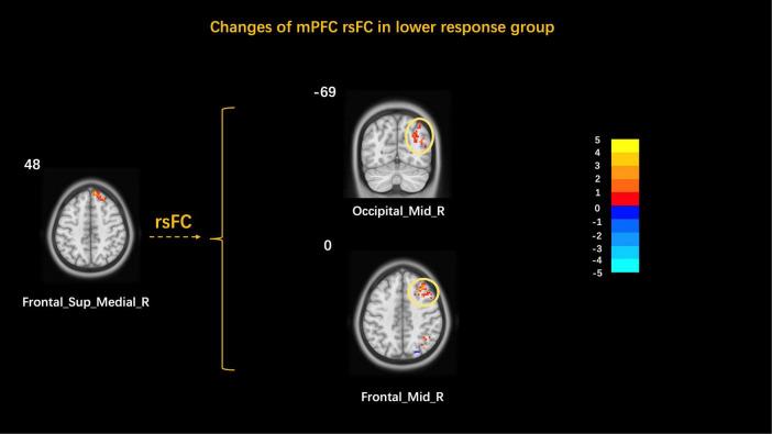 https://cdn.ncbi.nlm.nih.gov/pmc/blobs/1460/9022633/14128875fa37/fnins-16-801899-g004.jpg