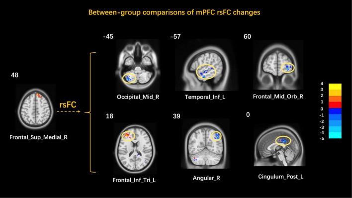 https://cdn.ncbi.nlm.nih.gov/pmc/blobs/1460/9022633/1e7650d61b8c/fnins-16-801899-g005.jpg