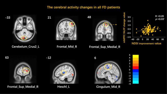 https://cdn.ncbi.nlm.nih.gov/pmc/blobs/1460/9022633/5e8afdacb884/fnins-16-801899-g001.jpg