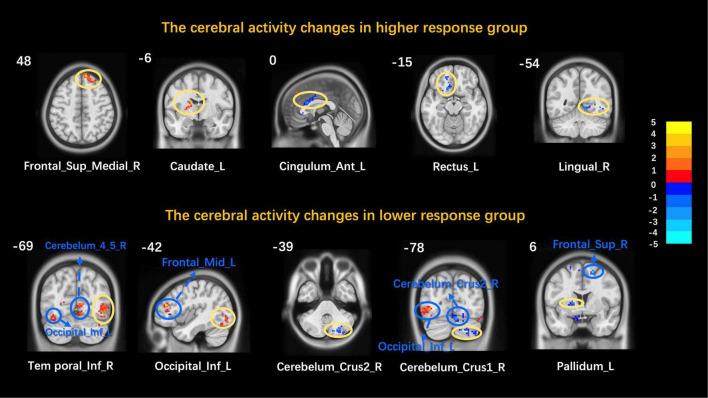 https://cdn.ncbi.nlm.nih.gov/pmc/blobs/1460/9022633/cccb9e67e6a5/fnins-16-801899-g002.jpg
