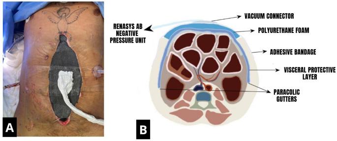 https://cdn.ncbi.nlm.nih.gov/pmc/blobs/1461/12084225/fa8d3e5d03f0/423_2025_3725_Fig2_HTML.jpg