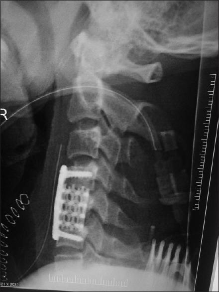 https://cdn.ncbi.nlm.nih.gov/pmc/blobs/1462/6702992/542986af8c0c/AJNS-14-843-g003.jpg