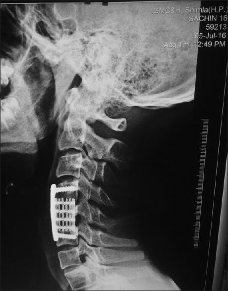 https://cdn.ncbi.nlm.nih.gov/pmc/blobs/1462/6702992/69979f0d0b8e/AJNS-14-843-g004.jpg