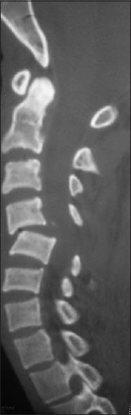 https://cdn.ncbi.nlm.nih.gov/pmc/blobs/1462/6702992/7f3b37d7d7fe/AJNS-14-843-g001.jpg