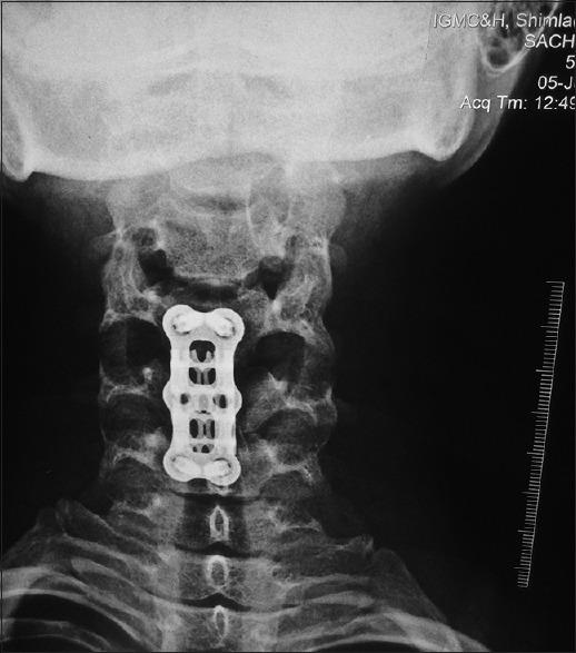 https://cdn.ncbi.nlm.nih.gov/pmc/blobs/1462/6702992/e185ba035208/AJNS-14-843-g005.jpg