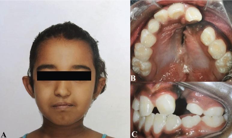 https://cdn.ncbi.nlm.nih.gov/pmc/blobs/146e/6174020/eb22014e2544/jced-10-e746-g001.jpg