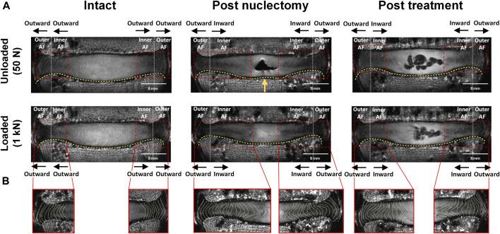 https://cdn.ncbi.nlm.nih.gov/pmc/blobs/1471/10577660/7bb075ad4065/fbioe-11-1229388-g004.jpg